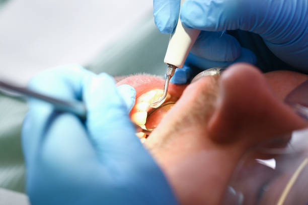 Best Emergency Treatment for Toothache in Caddo Mills, TX